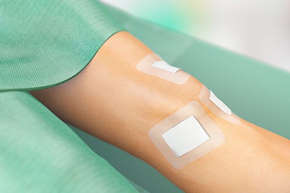 Sorbact-bandasje over kneet etter artroskopi.