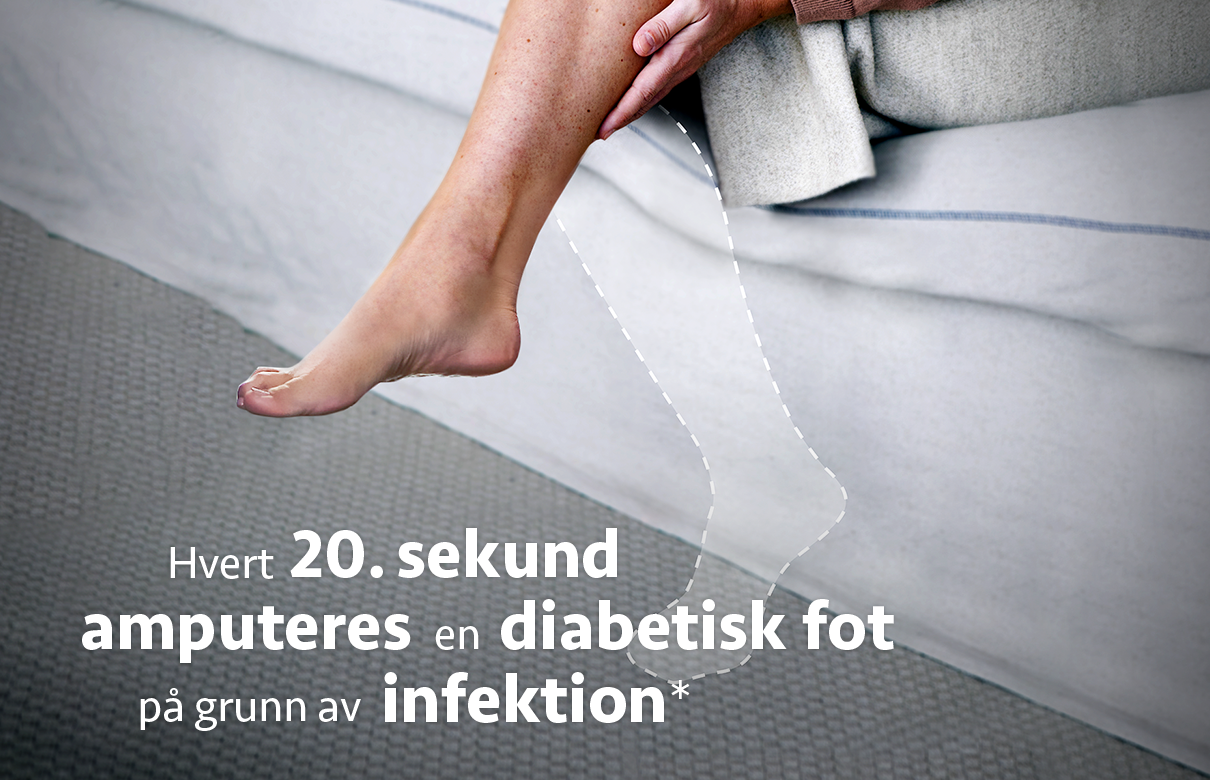 Et ben med stiplet kontur av en amputert fot. Tekst i bilde: Hvert 20. sekund amputeres en diabetisk fot på grunn av infeksjon*